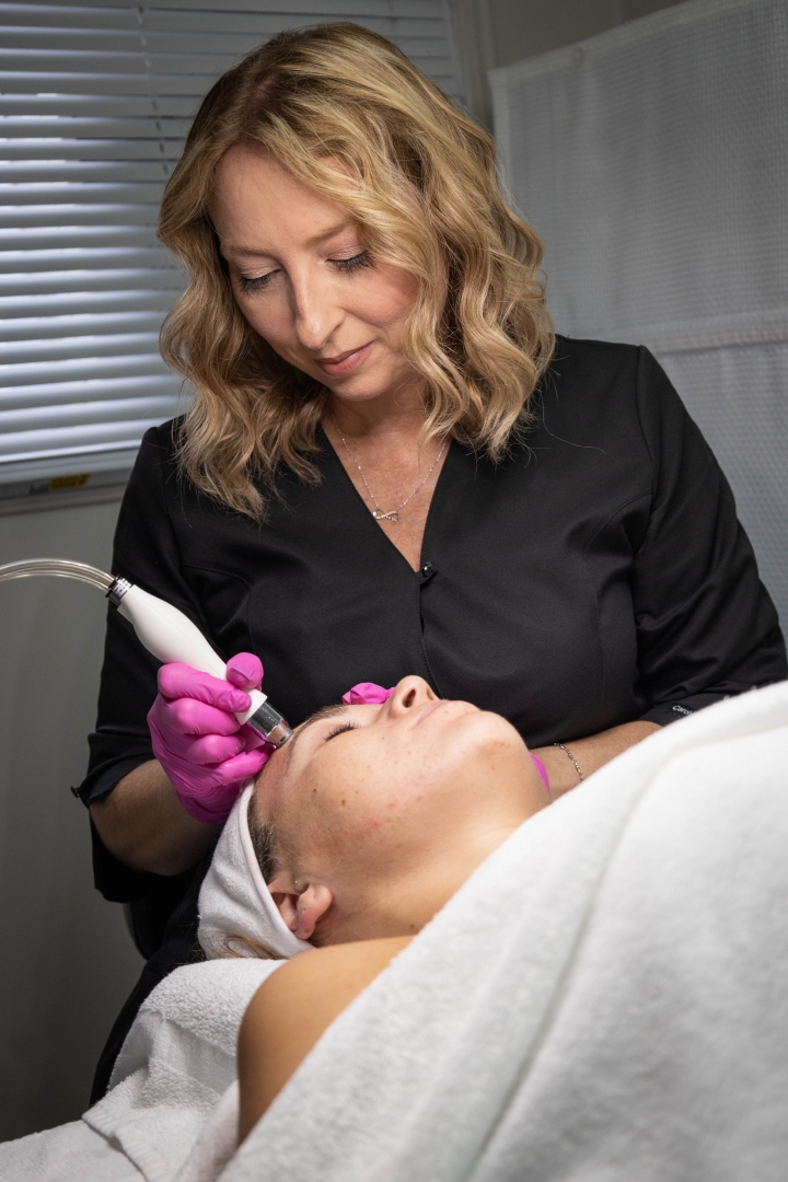 bela md Isabelle Cote microdermabrasion